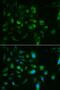 Toll Like Receptor 8 antibody, LS-C747976, Lifespan Biosciences, Immunofluorescence image 