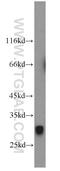 ADAM Metallopeptidase Domain 17 antibody, 20259-1-AP, Proteintech Group, Western Blot image 