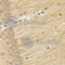 Transcobalamin 2 antibody, A5755, ABclonal Technology, Immunohistochemistry paraffin image 