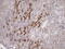 SAM Domain, SH3 Domain And Nuclear Localization Signals 1 antibody, M08977, Boster Biological Technology, Immunohistochemistry paraffin image 