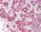 Lysosomal Associated Membrane Protein 1 antibody, TA317793, Origene, Immunohistochemistry paraffin image 