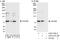 WD Repeat And Coiled Coil Containing antibody, A303-337A, Bethyl Labs, Western Blot image 