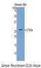 Glucuronidase Beta antibody, LS-C294227, Lifespan Biosciences, Western Blot image 