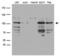 DExD/H-Box Helicase 58 antibody, LS-C796574, Lifespan Biosciences, Western Blot image 