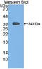 Signal Transducing Adaptor Molecule antibody, LS-C314798, Lifespan Biosciences, Western Blot image 