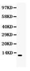 C-C Motif Chemokine Ligand 5 antibody, PB9573, Boster Biological Technology, Western Blot image 