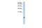 Histone Cluster 2 H2A Family Member A4 antibody, GTX45851, GeneTex, Western Blot image 