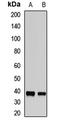 Transducer Of ERBB2, 2 antibody, orb412570, Biorbyt, Western Blot image 