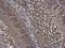 RuvB Like AAA ATPase 1 antibody, NBP2-20245, Novus Biologicals, Immunohistochemistry paraffin image 