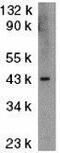 DNA Fragmentation Factor Subunit Alpha antibody, GTX31638, GeneTex, Western Blot image 