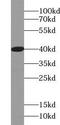 Acyl-CoA Thioesterase 7 antibody, FNab00093, FineTest, Western Blot image 
