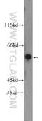 PRAME antibody, 11438-1-AP, Proteintech Group, Western Blot image 