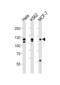 Fibroblast Growth Factor Receptor 2 antibody, LS-C97519, Lifespan Biosciences, Western Blot image 