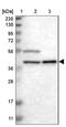 Spermatogenesis-associated protein 4 antibody, NBP1-80731, Novus Biologicals, Western Blot image 