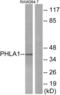 Pleckstrin Homology Like Domain Family A Member 1 antibody, abx014055, Abbexa, Western Blot image 