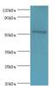 Calcium/Calmodulin Dependent Protein Kinase IV antibody, LS-C377398, Lifespan Biosciences, Western Blot image 