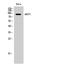 ATP Binding Cassette Subfamily F Member 1 antibody, STJ91416, St John