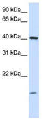 Transmembrane protein 79 antibody, TA339608, Origene, Western Blot image 