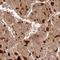 Zinc Finger Protein 101 antibody, NBP2-34197, Novus Biologicals, Immunohistochemistry frozen image 