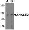 Kiaa0692 antibody, PA5-72736, Invitrogen Antibodies, Western Blot image 