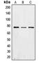 Eukaryotic Translation Initiation Factor 2 Alpha Kinase 2 antibody, LS-C352730, Lifespan Biosciences, Western Blot image 