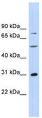 Aspartate Beta-Hydroxylase antibody, TA335749, Origene, Western Blot image 
