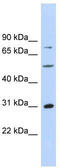 Aspartate Beta-Hydroxylase antibody, TA335749, Origene, Western Blot image 