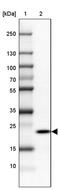 Ribonuclease P And MRP Subunit P25 antibody, PA5-61369, Invitrogen Antibodies, Western Blot image 