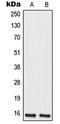 Mitochondrial Ribosomal Protein S12 antibody, LS-C352795, Lifespan Biosciences, Western Blot image 