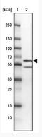 Sorting Nexin 8 antibody, NBP2-31672, Novus Biologicals, Western Blot image 