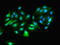 Glutamic-Oxaloacetic Transaminase 1 antibody, LS-B12294, Lifespan Biosciences, Immunofluorescence image 