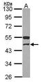 Glutaryl-CoA Dehydrogenase antibody, GTX114427, GeneTex, Western Blot image 