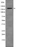 ALK Receptor Tyrosine Kinase antibody, PA5-64812, Invitrogen Antibodies, Western Blot image 