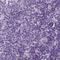 Keratin 25 antibody, NBP2-58547, Novus Biologicals, Immunohistochemistry paraffin image 