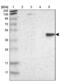 Gamma-Butyrobetaine Hydroxylase 1 antibody, NBP1-88695, Novus Biologicals, Western Blot image 