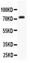 Potassium Voltage-Gated Channel Subfamily D Member 3 antibody, PB9229, Boster Biological Technology, Western Blot image 