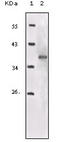 Insulin Like Growth Factor 1 Receptor antibody, STJ98159, St John