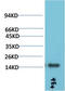 Transthyretin antibody, STJ98882, St John