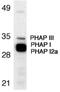 Acidic leucine-rich nuclear phosphoprotein 32 family member A antibody, PA1-28342, Invitrogen Antibodies, Western Blot image 