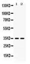 CD58 Molecule antibody, PA5-78992, Invitrogen Antibodies, Western Blot image 