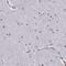 Alpha-N-Acetylgalactosaminidase antibody, PA5-51433, Invitrogen Antibodies, Immunohistochemistry paraffin image 