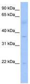 TRNA Methyltransferase 10B antibody, TA343998, Origene, Western Blot image 