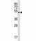 MOK Protein Kinase antibody, F43706-0.4ML, NSJ Bioreagents, Western Blot image 