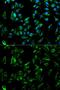 Tropomyosin 3 antibody, GTX16386, GeneTex, Immunofluorescence image 