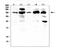 Platelet Derived Growth Factor Receptor Alpha antibody, PB9771, Boster Biological Technology, Western Blot image 