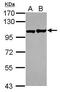 EPH Receptor A1 antibody, PA5-29315, Invitrogen Antibodies, Western Blot image 