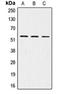 LDL Receptor Related Protein 11 antibody, orb215330, Biorbyt, Western Blot image 