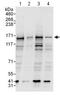 ATP Binding Cassette Subfamily B Member 1 antibody, ab129450, Abcam, Western Blot image 