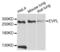 Envoplakin antibody, PA5-76550, Invitrogen Antibodies, Western Blot image 