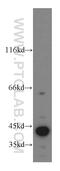 Mitogen-Activated Protein Kinase 12 antibody, 20184-1-AP, Proteintech Group, Western Blot image 